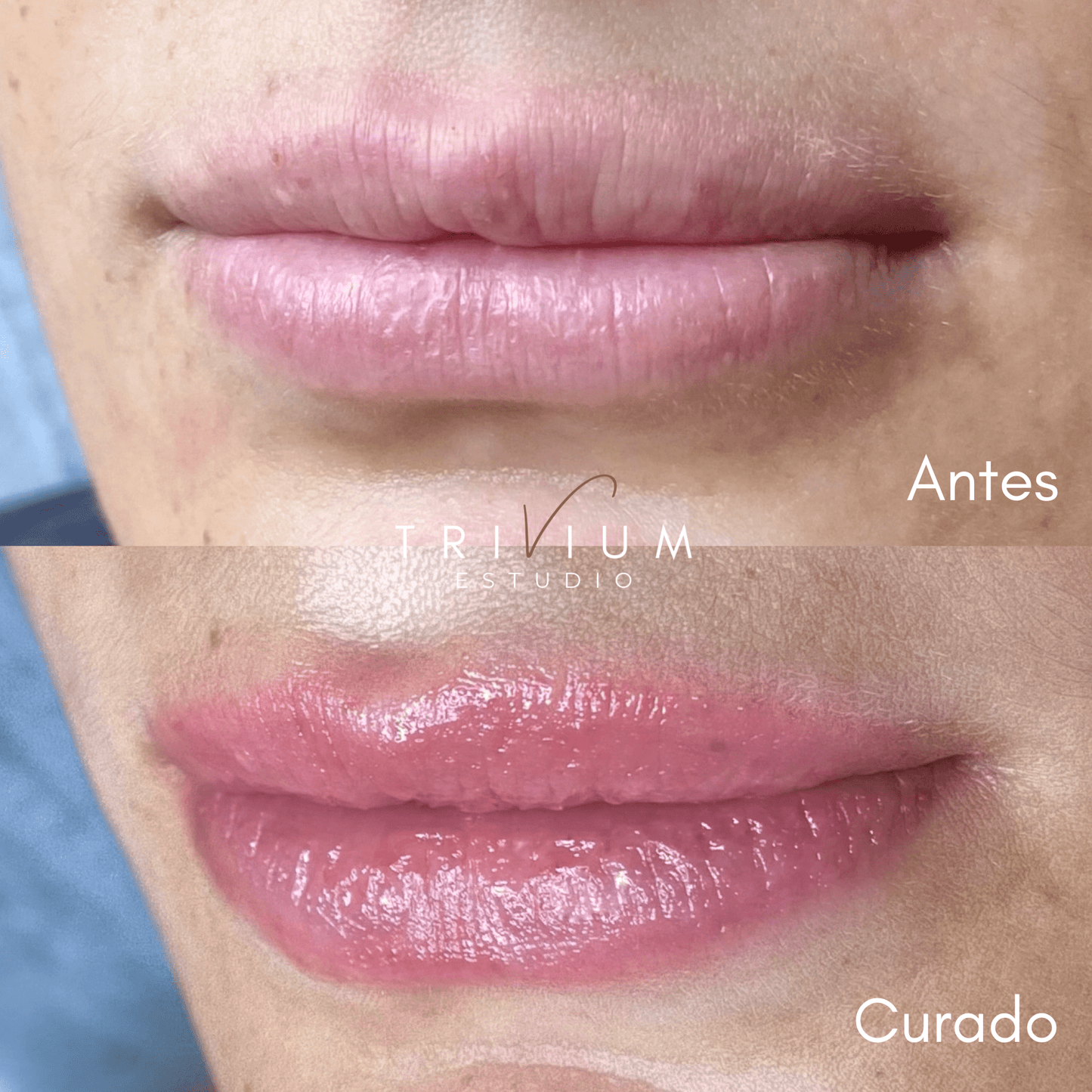 Micropigmentación de Labios