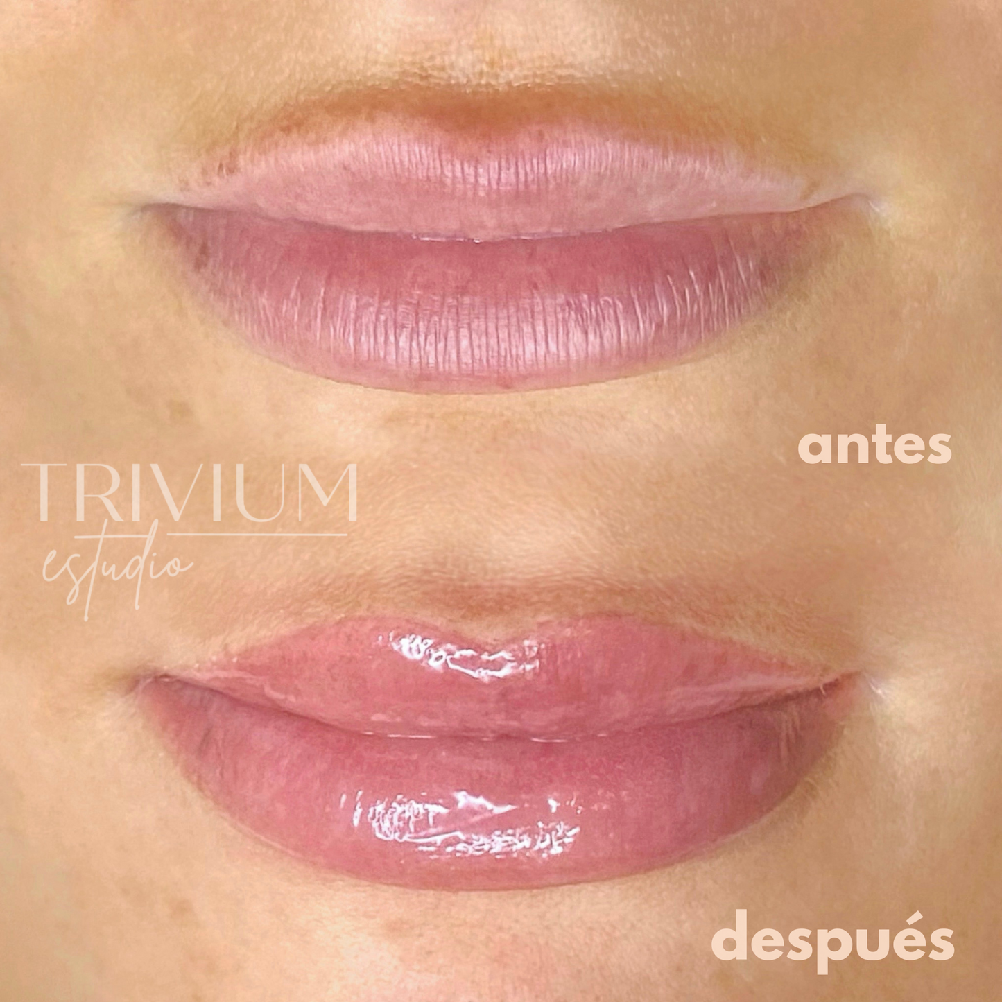 micropigmentacion labios madrid