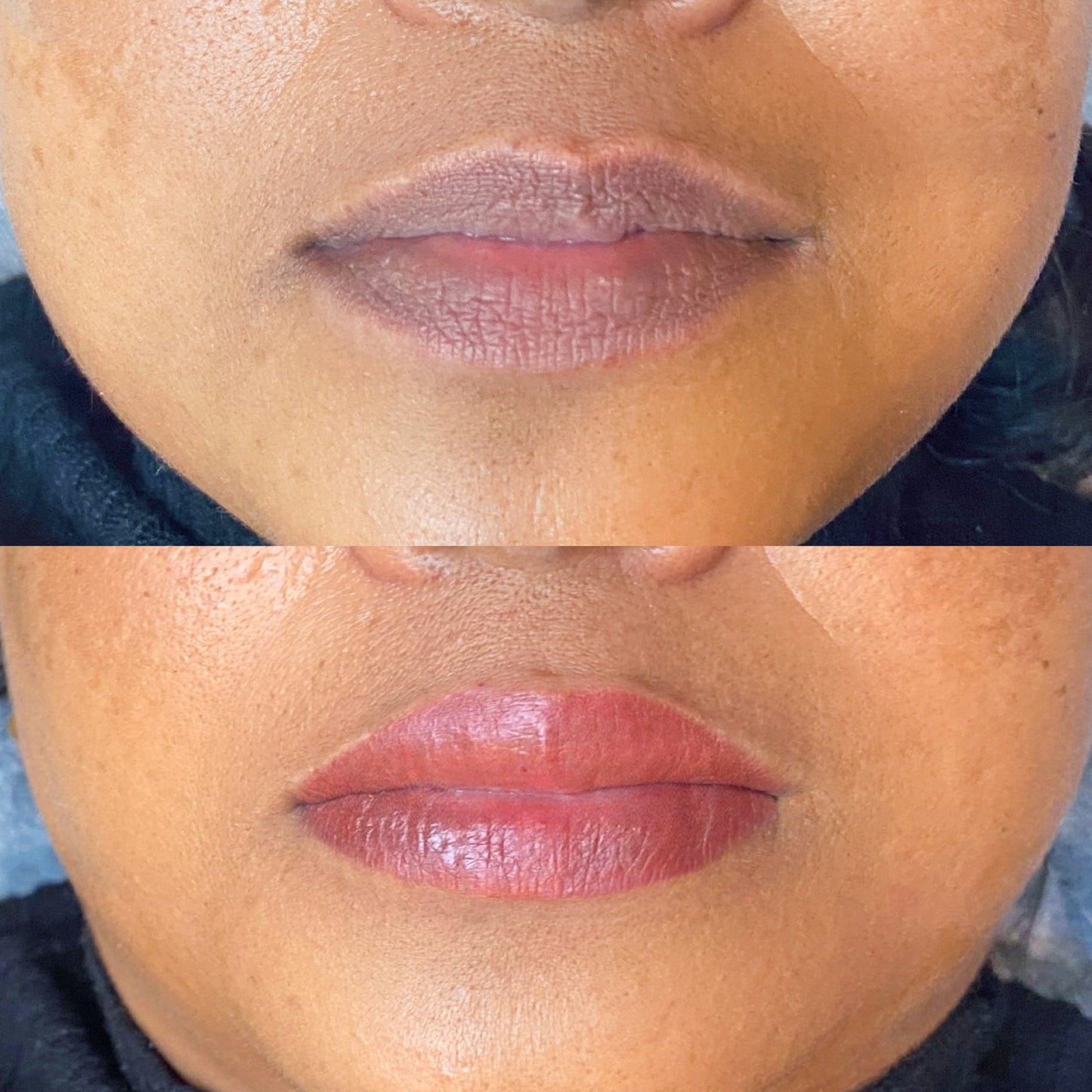 Neutralización Labios Oscuros