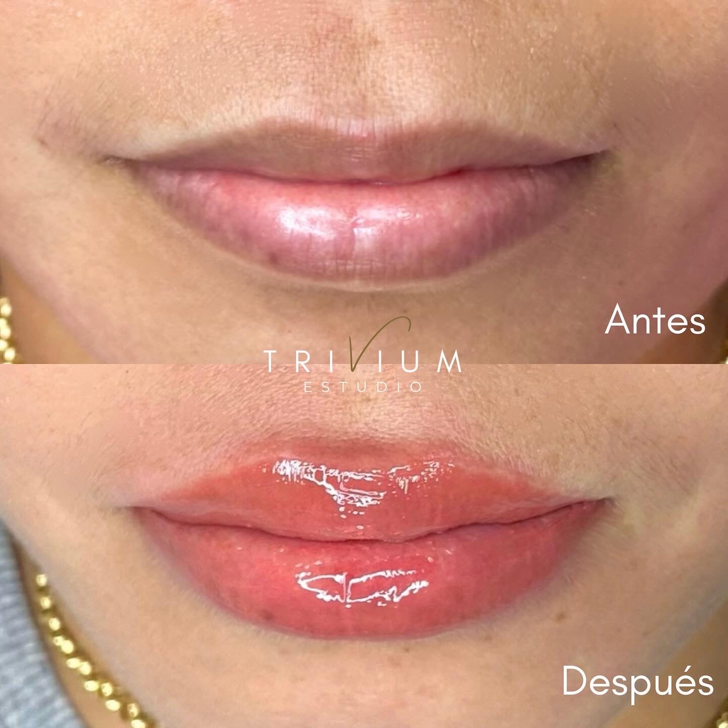 neutralizacion labios oscuros