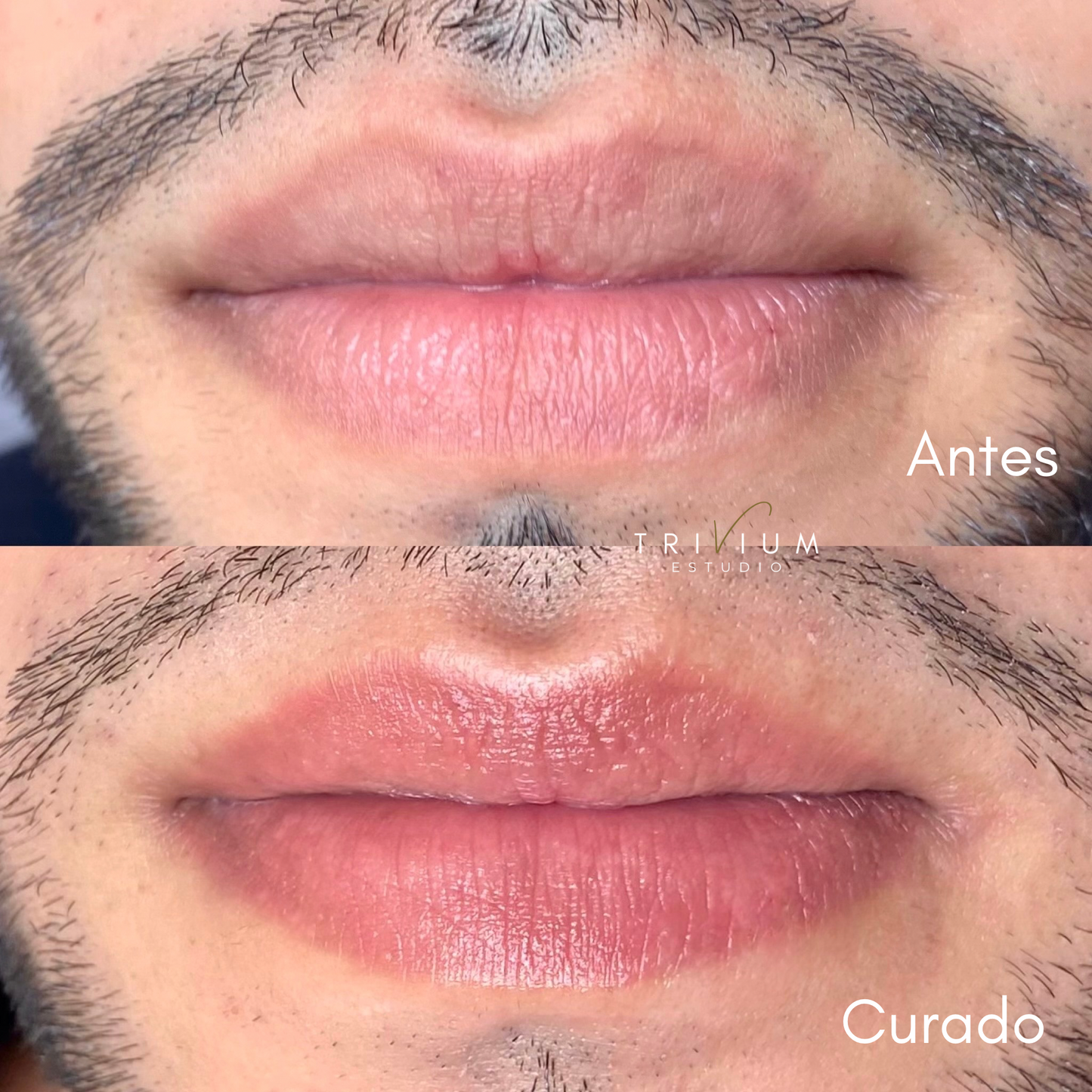 Micropigmentación de Labios