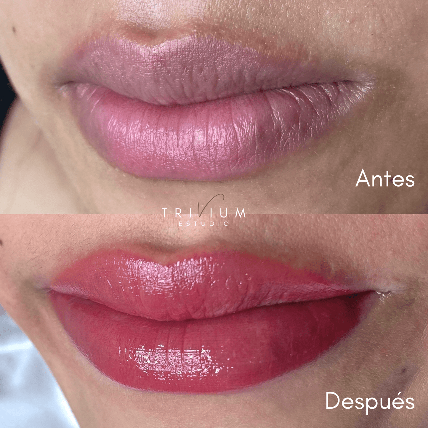 neutralizacion labios oscuros