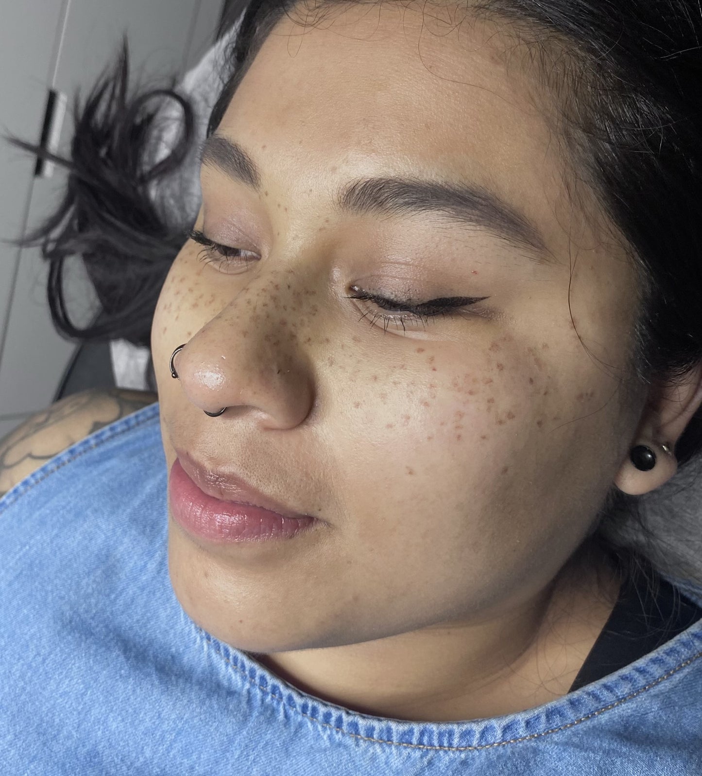 Micropigmentación de Pecas