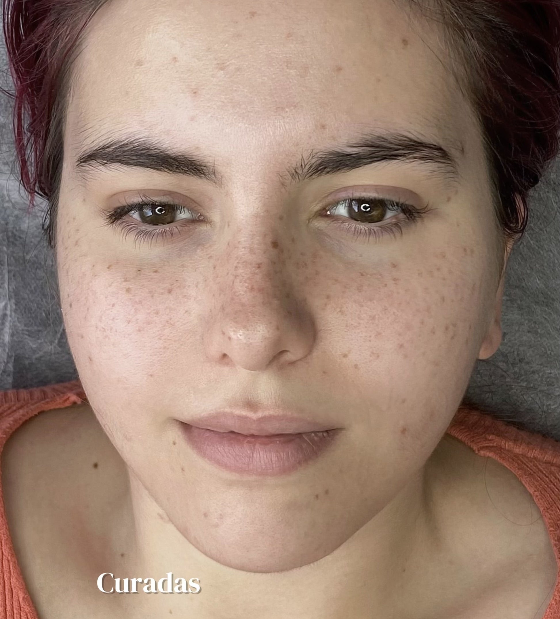 faux freckles tattoo healed