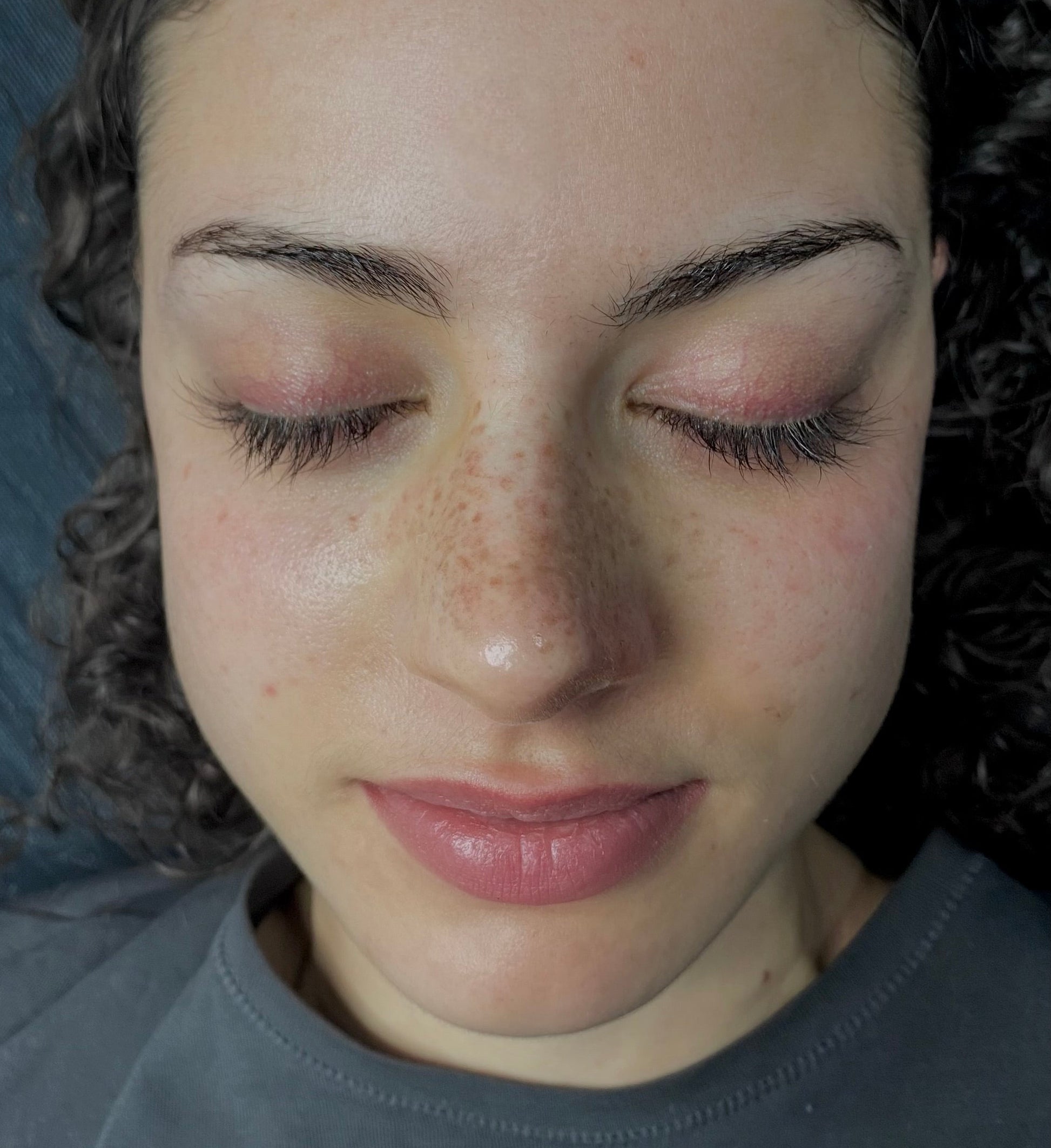 micropigmentacion pecas contorno nariz